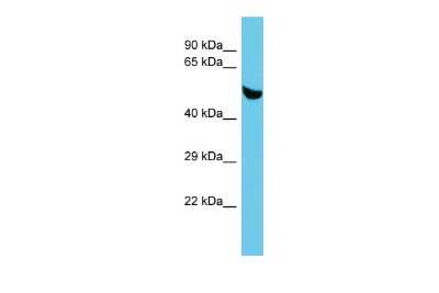 Western Blot: C5orf22 Antibody [NBP2-82924]