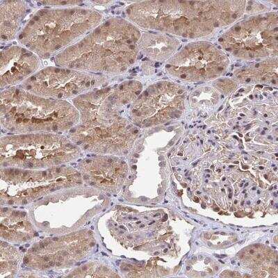 Immunohistochemistry-Paraffin: C5orf24 Antibody [NBP2-31686]