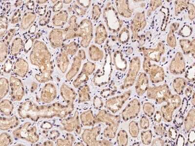 Immunohistochemistry-Paraffin: C5orf24 Antibody [NBP2-97988]