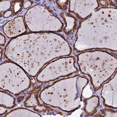 Immunohistochemistry-Paraffin: C5orf30 Antibody [NBP2-14416]
