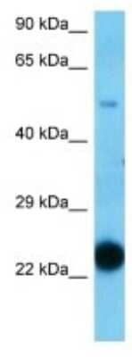 Western Blot: C5orf30 Antibody [NBP3-10736]