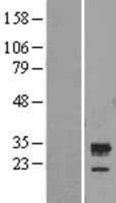 Western Blot: C5orf30 Overexpression Lysate [NBL1-08490]