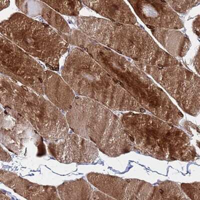 Immunohistochemistry-Paraffin: C5orf34 Antibody [NBP1-91735]