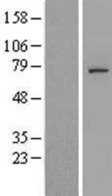 Western Blot: C5orf34 Overexpression Lysate [NBL1-08492]