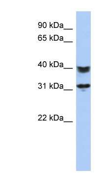 Western Blot: SETD9 Antibody [NBP1-56742]