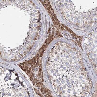 Immunohistochemistry-Paraffin: C5orf36 Antibody [NBP1-88257]