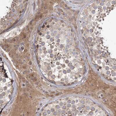 Immunohistochemistry-Paraffin: C5orf36 Antibody [NBP2-38379]