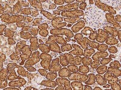 Immunohistochemistry-Paraffin: C5orf36 Antibody [NBP3-06008]