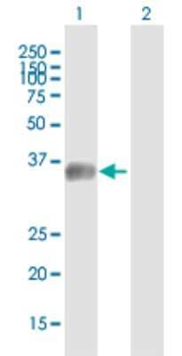 Western Blot: C5orf36 Antibody [H00285600-B01P]