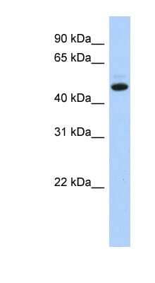 Western Blot: C5orf36 Antibody [NBP1-56799]