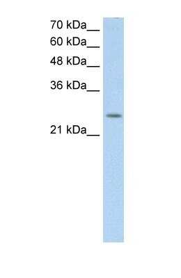 Western Blot: C5orf4 Antibody [NBP1-60125]