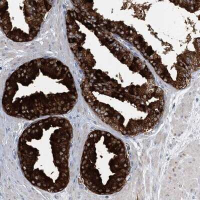 Immunohistochemistry-Paraffin: TRAPPC13 Antibody [NBP1-94021]