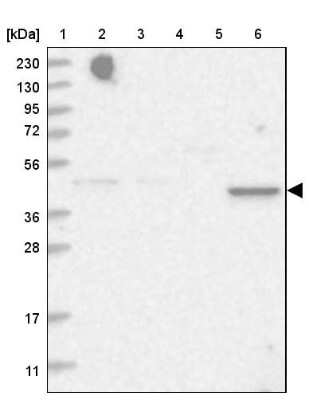 Western Blot: TRAPPC13 Antibody [NBP1-94021]