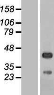 Western Blot: MRN Complex Interacting Protein Overexpression Lysate [NBL1-08498]