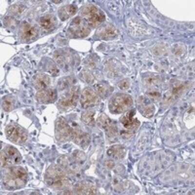 Immunohistochemistry-Paraffin: C5orf46 Antibody [NBP3-17154]