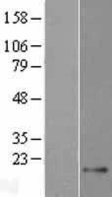 Western Blot: TEX43 Overexpression Lysate [NBP2-04498]