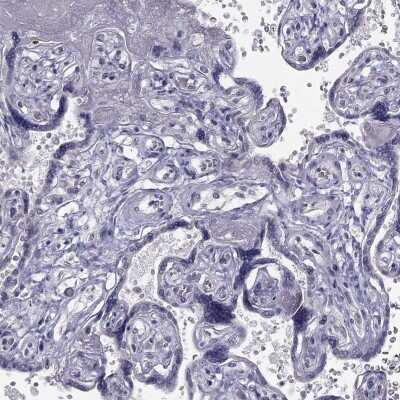 Immunohistochemistry-Paraffin: C5orf49 Antibody [NBP2-14530]