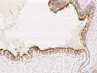 Immunohistochemistry-Paraffin: C5orf49 Antibody [NBP2-98031]