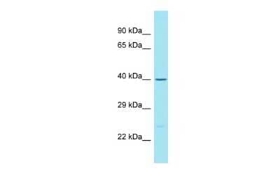 Western Blot: C5orf50 Antibody [NBP3-10762]