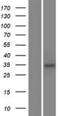 Western Blot: C5orf51 Overexpression Lysate [NBP2-05046]