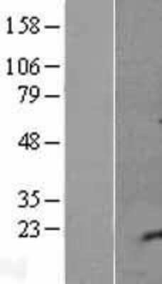 Western Blot: IGIP Overexpression Lysate [NBL1-12612]