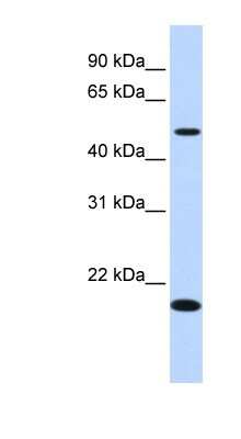 Western Blot: EXOC3-AS1 Antibody [NBP1-70474]