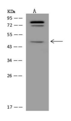 Western Blot: C5orf60 Antibody [NBP3-06034]