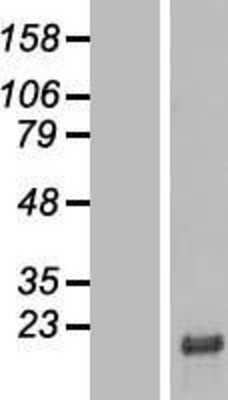 Western Blot: SMIM29 Overexpression Lysate [NBL1-08502]