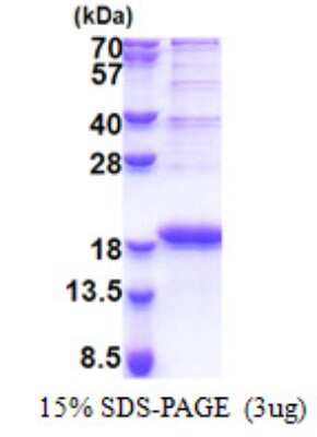 SDS-PAGE: Recombinant Human SMIM29 His Protein [NBP2-23195]