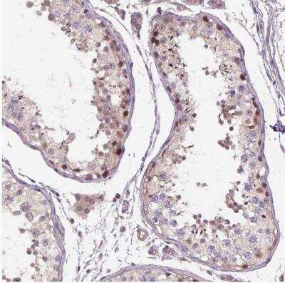 Immunohistochemistry-Paraffin: C6orf106 Antibody [NBP1-84224]