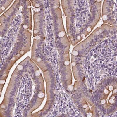 Immunohistochemistry-Paraffin: C6orf106 Antibody [NBP2-48623]