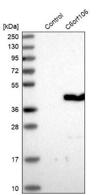 Western Blot: C6orf106 Antibody [NBP2-48623]