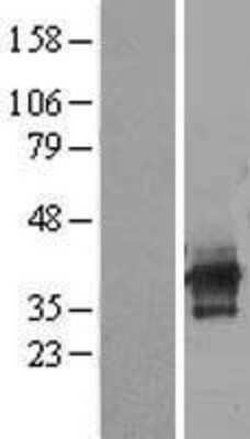 Western Blot: C6orf106 Overexpression Lysate [NBL1-08505]