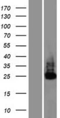 Western Blot: C6orf106 Overexpression Lysate [NBP2-09903]