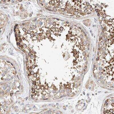 Immunohistochemistry: C6orf118 Antibody [NBP1-88727]