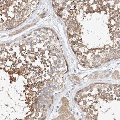 Immunohistochemistry-Paraffin: C6orf118 Antibody [NBP1-88726]