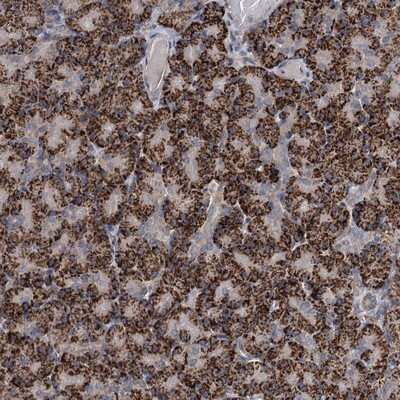 Immunohistochemistry-Paraffin: C6orf120 Antibody [NBP1-88979]