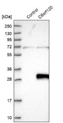 Western Blot: C6orf120 Antibody [NBP1-88979]