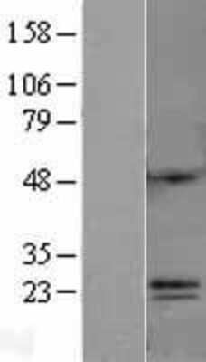 Western Blot: C6orf120 Overexpression Lysate [NBL1-08510]