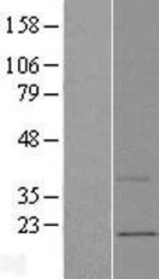 Western Blot: MNF1 Overexpression Lysate [NBL1-08511]