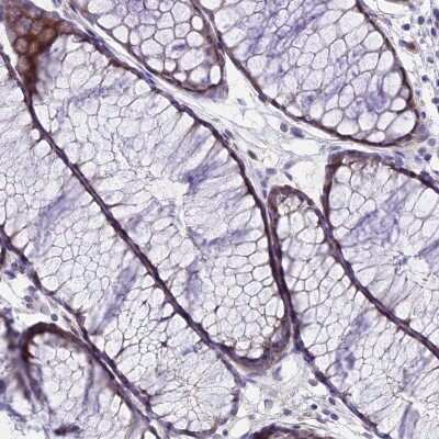 Immunohistochemistry-Paraffin: C6orf132 Antibody [NBP1-90776]