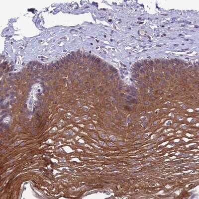Immunohistochemistry-Paraffin: C6orf132 Antibody [NBP1-90776]