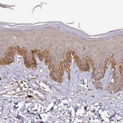 Immunohistochemistry-Paraffin: C6orf136 Antibody [NBP2-14419]