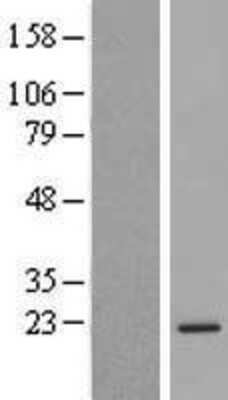 Western Blot: C6orf136 Overexpression Lysate [NBL1-08515]