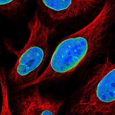 Immunocytochemistry/ Immunofluorescence: C6orf141 Antibody [NBP2-30735]