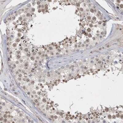 Immunohistochemistry-Paraffin: FAM217A Antibody [NBP1-93471]