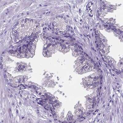 Immunohistochemistry-Paraffin: LRRC73 Antibody [NBP1-91736]