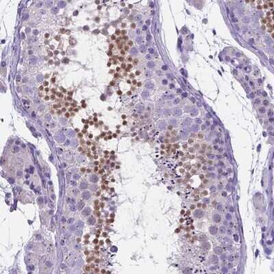 Immunohistochemistry-Paraffin: LRRC73 Antibody [NBP1-91736]