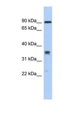 Western Blot: LRRC73 Antibody [NBP1-56949]