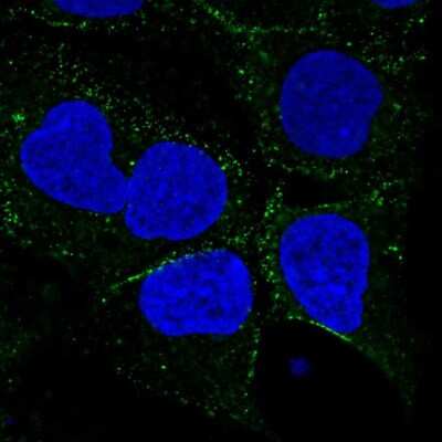 Immunocytochemistry/ Immunofluorescence: SMIM8 Antibody [NBP2-55878]